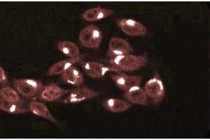 Immunofluorescence staining of HeLa cells (Human cervical epitheloid carcinoma, ATCC CCL-2. (TRADD 抗体  (AA 163-312))