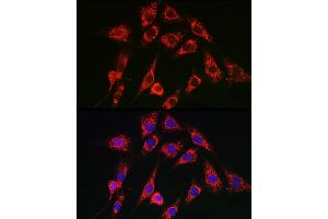 Immunofluorescence (IF) image for anti-ATPase, Ca++ Transporting, Cardiac Muscle, Slow Twitch 2 (ATP2A2) (AA 111-253) antibody (ABIN3021430)