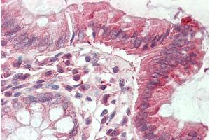 ABIN1781990 (5µg/ml) staining of paraffin embedded Human Colon. (CLIC1 抗体  (Internal Region))
