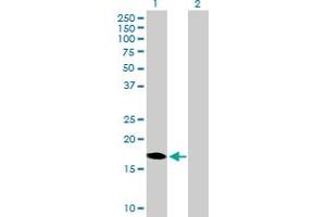 Western Blot analysis of DUX3 expression in transfected 293T cell line by DUX3 MaxPab polyclonal antibody. (DUX3 抗体  (AA 1-170))