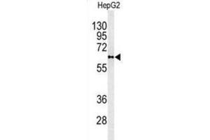 Western Blotting (WB) image for anti-Phospholipid Transfer Protein (PLTP) antibody (ABIN3003343)