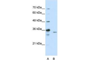 Western Blotting (WB) image for anti-Exosome Component 3 (EXOSC3) antibody (ABIN2462262) (EXOSC3 抗体)