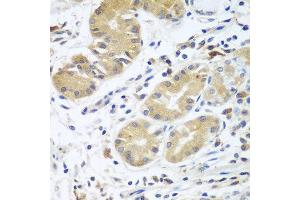 Immunohistochemistry of paraffin-embedded human stomach using CFD antibody at dilution of 1:100 (40x lens). (Adipsin 抗体)
