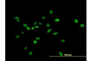 Immunofluorescence of purified MaxPab antibody to NUAK1 on HeLa cell. (NUAK1 抗体  (AA 1-661))