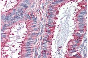 Human Uterus (formalin-fixed, paraffin-embedded) stained with GPR27 antibody ABIN410770 followed by biotinylated goat anti-rabbit IgG secondary antibody ABIN481713, alkaline phosphatase-streptavidin and chromogen. (GPR27 抗体  (Internal Region))