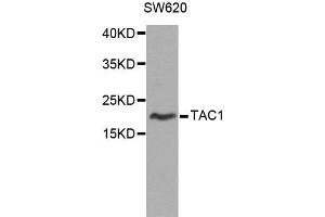 Western blot analysis of extracts of SW620 cells, using TAC1 antibody. (TAC1 抗体)