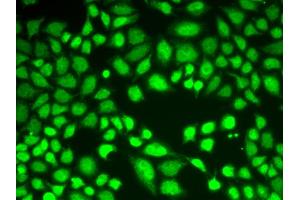 Immunofluorescence analysis of A549 cells using KDM1A antibody. (LSD1 抗体)