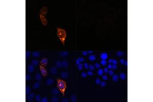 Immunofluorescence analysis of HeLa cells transfected with C (upper left) and untreated HeLa cells (upper right) using C Rabbit pAb (red, ABIN7266523) at dilution of 1:100.