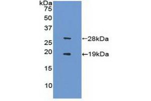 Detection of Recombinant FCN1, Human using Polyclonal Antibody to Sirtuin 1 (SIRT1) (SIRT1 抗体  (AA 244-498))