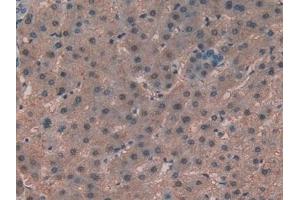Immunohistochemistry (IHC) image for anti-Alanine Aminotransferase (ALT) (AA 147-263) antibody (ABIN7438472)
