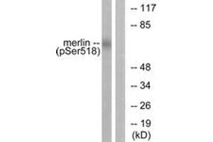 Western blot analysis of extracts from HuvEc cells treated with IFN-alpha 1000U/ml 18h, using Merlin (Phospho-Ser518) Antibody.