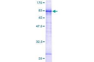 Image no. 1 for Lymphotoxin beta Receptor (TNFR Superfamily, Member 3) (LTBR) (AA 31-435) protein (GST tag) (ABIN1309876)