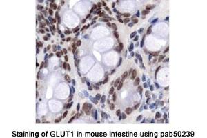 Image no. 1 for anti-Solute Carrier Family 2 (Facilitated Glucose Transporter), Member 1 (SLC2A1) (AA 1-100), (N-Term) antibody (ABIN363548)