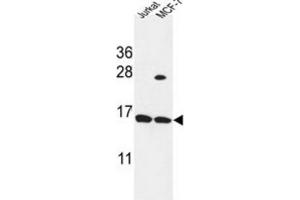 Western Blotting (WB) image for anti-Small Proline Rich Protein 1A (SPRR1A) antibody (ABIN3004230) (SPRR1A 抗体)