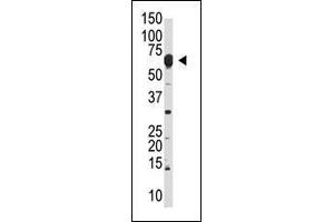Western Blotting (WB) image for anti-Negative Regulator of Ubiquitin-Like Proteins 1 (NUB1) (AA 87-117), (N-Term) antibody (ABIN389078)