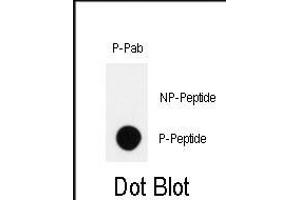 Dot blot analysis of anti-Phospho-HIPK2-p Antibody (ABIN389999 and ABIN2839776) on nitrocellulose membrane. (HIPK2 抗体  (pTyr361))