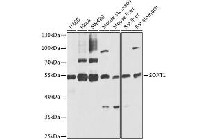 Western blot analysis of extracts of various cell lines, using SO antibody (ABIN6129624, ABIN6148259, ABIN6148260 and ABIN6221917) at 1:1000 dilution. (SOAT1 抗体  (AA 1-130))