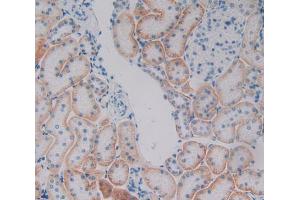 Used in DAB staining on fromalin fixed paraffin- embedded kidney tissue (Plakophilin 1 抗体  (AA 500-742))