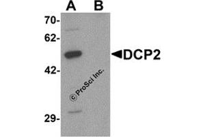 Western Blotting (WB) image for anti-DCP2 Decapping Enzyme Homolog (DCP2) (C-Term) antibody (ABIN1077379) (DCP2 抗体  (C-Term))