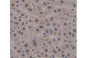 Used in DAB staining on fromalin fixed paraffin- embedded Kidney tissue (DP1 抗体  (AA 6-410))
