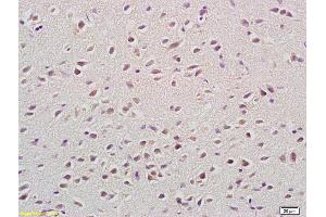 Immunohistochemistry (IHC) image for anti-Sema Domain, Immunoglobulin Domain (Ig), Transmembrane Domain (TM) and Short Cytoplasmic Domain, (Semaphorin) 4A (Sema4a) (AA 361-460) antibody (ABIN873193)
