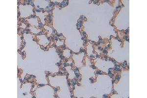 Used in DAB staining on fromalin fixed paraffin- embedded lung tissue (CSK 抗体  (AA 243-438))
