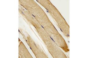 Immunohistochemistry (Paraffin-embedded Sections) (IHC (p)) image for anti-Solute Carrier Family 16, Member 10 (Aromatic Amino Acid Transporter) (SLC16A10) (AA 301-329), (C-Term) antibody (ABIN657159)