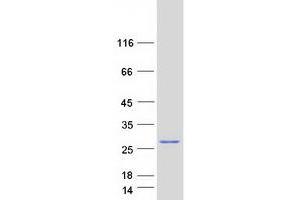 Western Blotting (WB) image for Basic Transcription Factor 3-Like 4 (BTF3L4) (Transcript Variant 1) protein (Myc-DYKDDDDK Tag) (ABIN2715347)