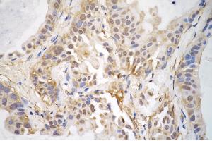 anti-Lipoma-preferred partner (LPP) antibody