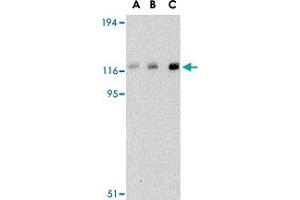 Western blot analysis of CBL in Daudi cell lysate with CBL polyclonal antibody  at (A) 0. (CBL 抗体  (C-Term))