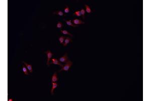 ABIN6266833 staining HeLa  cells by IF/ICC. (ARMCX3 抗体  (N-Term))