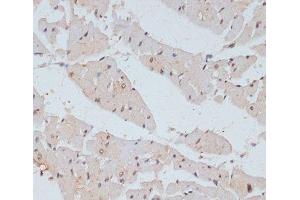 Immunohistochemistry (Paraffin-embedded Sections) (IHC (p)) image for anti-Breast Cancer 1 (BRCA1) (pSer1423) antibody (ABIN7265138)