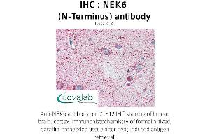 Image no. 1 for anti-NIMA (Never in Mitosis Gene A)-Related Kinase 6 (NEK6) (N-Term) antibody (ABIN1737252) (NEK6 抗体  (N-Term))