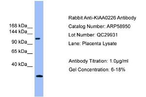 Western Blotting (WB) image for anti-KIAA0226 (KIAA0226) (Middle Region) antibody (ABIN2787888)