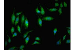Immunofluorescence (IF) image for anti-NADH Dehydrogenase (Ubiquinone) 1 beta Subcomplex, 5, 16kDa (NDUFB5) (AA 100-189) antibody (ABIN7160924)