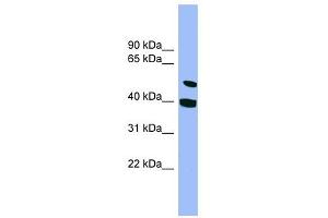 SMU1 antibody used at 1 ug/ml to detect target protein. (SMU1 抗体)