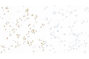 Immunocytochemistry (ICC) image for anti-Signal Transducer and Activator of Transcription 3 (Acute-Phase Response Factor) (STAT3) (pTyr705) antibody (ABIN7453986)