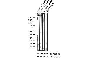 Western blot analysis of Phospho-Histone H2A. (H2AFX 抗体  (pSer139))