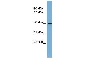 WB Suggested Anti-VPS37C Antibody Titration: 0. (VPS37C 抗体  (N-Term))