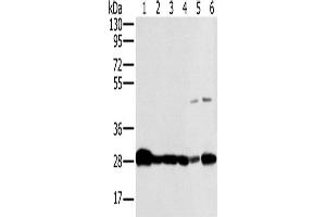 Western Blotting (WB) image for anti-NADH Dehydrogenase (Ubiquinone) Fe-S Protein 3, 30kDa (NADH-Coenzyme Q Reductase) (NDUFS3) antibody (ABIN2423863) (NDUFS3 抗体)