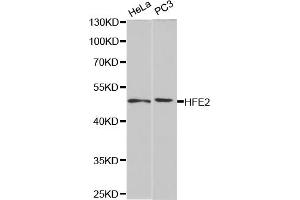 Western blot analysis of extracts of various cell lines, using HFE2 antibody (ABIN5973085) at 1/1000 dilution. (HFE2 抗体)