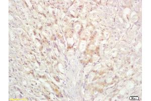 Immunohistochemistry (Paraffin-embedded Sections) (IHC (p)) image for anti-BCL2-Associated Agonist of Cell Death (BAD) (AA 101-204) antibody (ABIN674709)