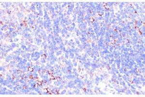 Immunohistochemistry of paraffin-embedded Mouse spleen using ZYX Polyclonal Antibody at dilution of 1:100 (40x lens). (ZYX 抗体)