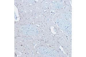 Immunohistochemistry of paraffin-embedded human brain using Phospho-Tau-S396 Rabbit mAb (ABIN7268523) at dilution of 1:100 (40x lens). (MAPT 抗体  (pSer396))