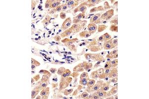 (ABIN654065 and ABIN2843962) staining AHSG in human liver tissue sections by Immunohistochemistry (IHC-P - paraformaldehyde-fixed, paraffin-embedded sections).