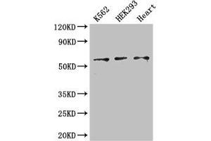 Western Blot Positive WB detected in: K562 whole cell lysate, HEK293 whole cell lysate, Mouse heart tissue All lanes: ZRSR2 antibody at 3 μg/mL Secondary Goat polyclonal to rabbit IgG at 1/50000 dilution Predicted band size: 59 kDa Observed band size: 59 kDa (ZRSR2 抗体  (AA 191-372))