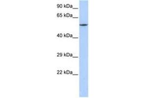 Image no. 1 for anti-Calcium Channel, Voltage-Dependent, beta 1 Subunit (CACNB1) (C-Term) antibody (ABIN6742715) (CACNB1 抗体  (C-Term))