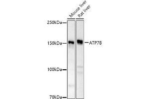 Western blot analysis of extracts of various cell lines, using B antibody (ABIN6127395, ABIN6137355, ABIN6137356 and ABIN6221328) at 1:500 dilution. (ATP7B 抗体  (AA 1055-1354))