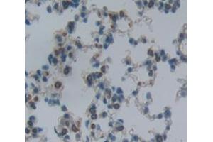 IHC-P analysis of Kidney tissue, with DAB staining. (ITGA2 抗体  (AA 212-370))