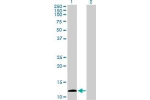Western Blot analysis of KISS1 expression in transfected 293T cell line by KISS1 MaxPab polyclonal antibody. (KISS1 抗体  (AA 1-138))